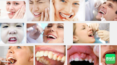 U răng là căn bệnh mà mọi người rất dễ mắc phải