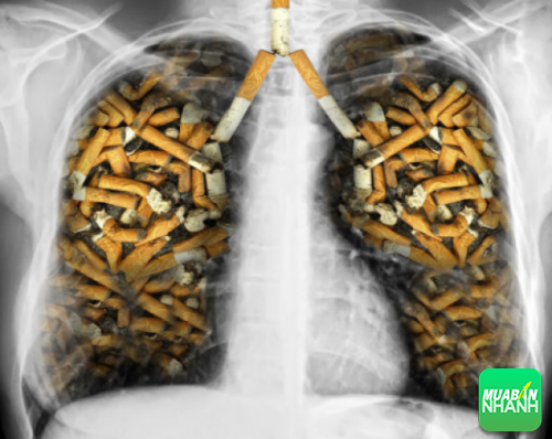 Hút thuốc là nguyên nhân chính gây ra ung thư phổi