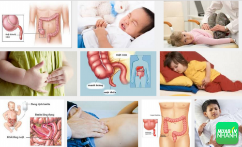 Tình trạng trẻ em mắc phải bệnh viêm ruột thừa đang ngày càng gia tăng