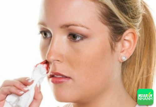 Chảy máu mũi cũng có thể là triệu chứng của bệnh nguy hiểm