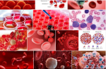 Ung thư tế bào máu biểu hiện như thế nào ?