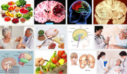 Chế độ dinh dưỡng khoa học tốt cho bạn khi mắc phải bệnh u não