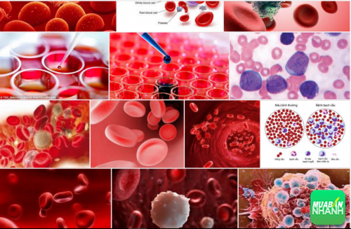 Ung thư tế bào máu biểu hiện như thế nào ?, 41, Phương Thảo, Cẩm Nang Sức Khỏe, 21/09/2016 13:42:42