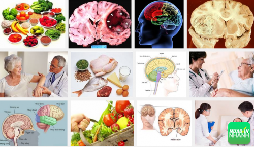 Chế độ dinh dưỡng khoa học tốt cho bạn khi mắc phải bệnh u não, 143, Phương Thảo, Cẩm Nang Sức Khỏe, 30/09/2016 11:29:24