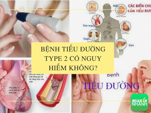 Bệnh tiểu đường type 2 có nguy hiểm không?, 462, Mai Tâm, Cẩm Nang Sức Khỏe, 04/05/2017 11:16:36